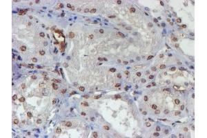 Immunohistochemical staining of paraffin-embedded Human Kidney tissue using anti-ELK3 mouse monoclonal antibody. (ELK3 antibody)