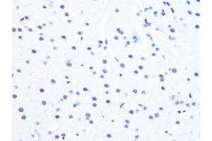 Immunohistochemistry of paraffin-embedded mouse brain using NUM Rabbit mAb (ABIN7269002) at dilution of 1:100 (40x lens). (NUMA1 antibody)