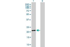Western Blot analysis of SYT16 expression in transfected 293T cell line by SYT16 MaxPab polyclonal antibody. (SYT16 antibody  (AA 1-203))
