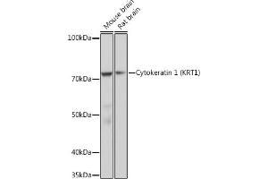 Western blot analysis of extracts of various cell lines, using Cytokeratin 1 (KRT1) (KRT1) Rabbit mAb (ABIN7268085) at 1:1000 dilution.