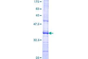 Image no. 1 for Platelet-Derived Growth Factor Receptor-Like (PDGFRL) (AA 276-375) protein (GST tag) (ABIN1314516) (PDGFRL Protein (AA 276-375) (GST tag))