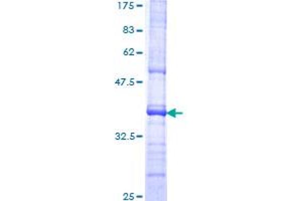 PDGFRL Protein (AA 276-375) (GST tag)