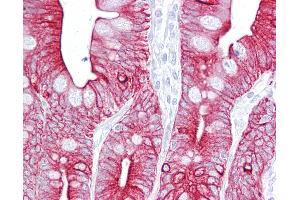 Anti-KRT8 / Cytokeratin 8 antibody IHC of human small intestine. (KRT8 antibody  (N-Term))
