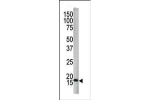 Image no. 1 for anti-Small Ubiquitin Related Modifier 4 (SUMO4) (Middle Region) antibody (ABIN356785) (SUMO4 antibody  (Middle Region))