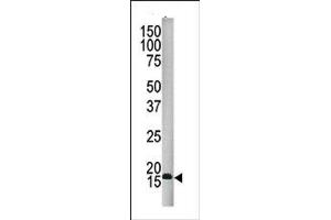 Image no. 1 for anti-Small Ubiquitin Related Modifier 4 (SUMO4) (Middle Region) antibody (ABIN356785) (SUMO4 antibody  (Middle Region))