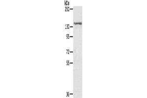 Gel: 6 % SDS-PAGE, Lysate: 40 μg, Lane: MCF7 cells, Primary antibody: ABIN7131203(STAG2 Antibody) at dilution 1/300, Secondary antibody: Goat anti rabbit IgG at 1/8000 dilution, Exposure time: 5 seconds (STAG2 antibody)