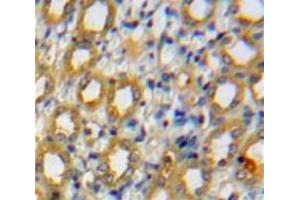 Used in DAB staining on fromalin fixed paraffin-embedded Kidney tissue (ADAMTS1 antibody  (AA 476-614))