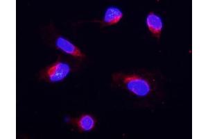 IF analysis of COX IV using anti-COX IV antibody (ABIN5692827). (COX IV antibody  (AA 59-169))