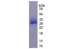 SDS-PAGE analysis of Mouse SOSTDC1 Protein. (SOSTDC1 Protein)