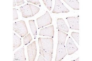 Immunohistochemistry of paraffin embedded rat skeletal muscle using CNG1 (ABIN7073608) at dilution of 1:700 (400x lens) (CNGA1 antibody)