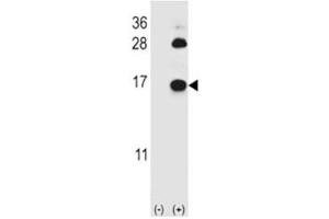 Western blot analysis of FABP4 antibody and 293 cell lysate (2 ug/lane) either nontransfected (Lane 1) or transiently transfected (2) with the FABP4 gene. (FABP4 antibody  (AA 1-30))