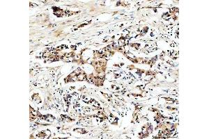 IHC analysis of USP5 using anti-USP5 antibody (ABIN7599551). (USP5 antibody  (AA 1-800))
