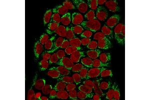 Immunofluorescence Analysis of Human MCF-7 cells labeling GnRH-R with GnRH-Receptor Mouse Monoclonal Antibody (F1G4) followed by Goat anti-mouse IgG-CF488 (Green). (GNRHR and LHCGR (AA 1-29), (N-Term) antibody)