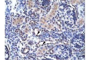 Image no. 1 for anti-TAF1 RNA Polymerase II, TATA Box Binding Protein (TBP)-Associated Factor, 250kDa (TAF1) (C-Term) antibody (ABIN6735891) (TAF1 antibody  (C-Term))
