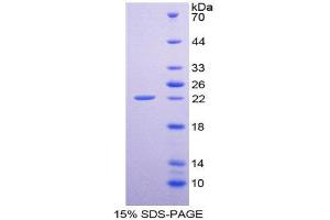 SDS-PAGE (SDS) image for Epiregulin (EREG) (AA 1-162) protein (His tag) (ABIN1981030) (Epiregulin Protein (EREG) (AA 1-162) (His tag))