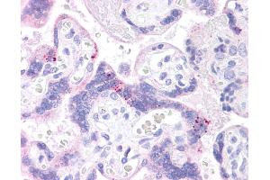 Immunohistochemistry (IHC) image for anti-ATP-Binding Cassette, Sub-Family B (MDR/TAP), Member 1 (ABCB1) (Middle Region) antibody (ABIN2773986) (ABCB1 antibody  (Middle Region))