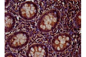 IHC image of ABIN7166237 diluted at 1:200 and staining in paraffin-embedded human appendix tissue performed on a Leica BondTM system. (PTP4A2 antibody  (AA 1-164))