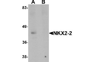 Western blot analysis of NKX2-2 in rat kidney tissue lysate with NKX2-2 antibody at 1 µg/mL in (A) the absence and (B) the presence of blocking peptide. (Nkx2-2 antibody  (Middle Region))