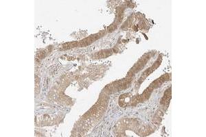 Immunohistochemical staining of human gallbladder with LIPT1 polyclonal antibody  shows moderate cytoplasmic positivity in glandular cells.