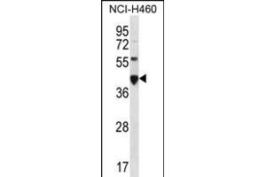 CEAC Antibody (N-term) (ABIN656216 and ABIN2845533) western blot analysis in NCI- cell line lysates (35 μg/lane). (CEACAM18 antibody  (N-Term))