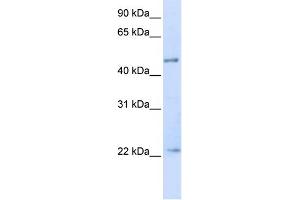 WB Suggested Anti-TRIM21 Antibody Titration:  0. (TRIM21 antibody  (N-Term))