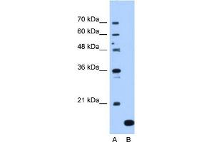 NAT13 antibody used at 1. (NAA50 antibody  (C-Term))