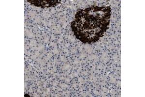 Immunohistochemical staining of human pancreas with WDR31 polyclonal antibody  shows strong cytoplasmic positivity in islet cells.