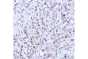 IHC analysis of Cdk2 using anti-Cdk2 antibody (ABIN7602522). (CDK2 antibody  (AA 81-298))