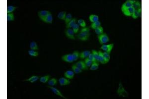 Immunofluorescence staining of PC-3 cells with ABIN7147167 at 1:133, counter-stained with DAPI. (CD59 antibody  (AA 26-102))