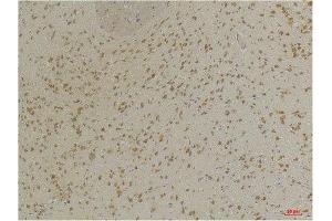 Immunohistochemistry (IHC) analysis of paraffin-embedded Mouse Brain Tissue using GABA A Receptor alpha3 Rabbit Polyclonal Antibody diluted at 1:200. (GABRA3 antibody)