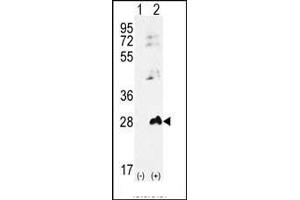 Western blot analysis of AK1 (arrow) using rabbit polyclonal AK1 Antibody (S45) (ABIN392794 and ABIN2842231). (Adenylate Kinase 1 antibody  (N-Term))