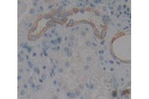 Figure. (EXT1 antibody  (AA 334-549))