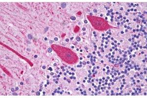 anti-Carboxylesterase 2 (CES2) (C-Term) antibody