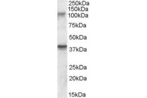 Image no. 1 for anti-Glutamate Receptor, Ionotropic, Kainate 3 (GRIK3) (Internal Region) antibody (ABIN375008) (GRIK3 antibody  (Internal Region))