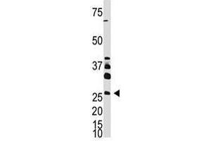 Image no. 1 for anti-Dickkopf Homolog 4 (Xenopus Laevis) (DKK4) (AA 7-36), (N-Term) antibody (ABIN357073) (DKK4 antibody  (N-Term))