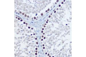 Immunohistochemistry of paraffin-embedded rat testis using Aurora B Rabbit pAb (ABIN7265783) at dilution of 1:150 (40x lens). (Aurora Kinase B antibody  (AA 1-344))