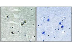 Immunohistochemical analysis of paraffin-embedded human brain tissue using MER/SKY (Phospho-Tyr749/681) antibody (left)or the same antibody preincubated with blocking peptide (right). (MerTK/Tyro3 antibody  (pTyr681, pTyr749))