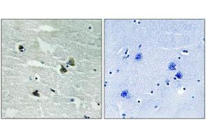 Immunohistochemical analysis of paraffin-embedded human brain tissue using MER/SKY (Phospho-Tyr749/681) antibody (left)or the same antibody preincubated with blocking peptide (right).