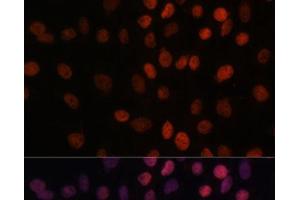 Immunofluorescence analysis of C6 cells using ARID1B Polyclonal Antibody at dilution of 1:100. (ARID1B antibody)