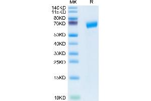 Human SLAMF6 on Tris-Bis PAGE under reduced condition. (SLAMF6 Protein (AA 22-226) (Fc Tag))