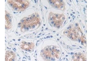 DAB staining on IHC-P; Samples: Human Stomach Tissue (MMP3 antibody  (AA 289-452))