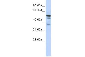 NMT1 antibody used at 1 ug/ml to detect target protein. (NMT1 antibody  (N-Term))