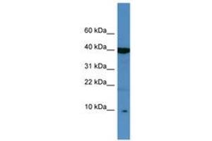 Image no. 1 for anti-serine Peptidase Inhibitor, Kazal Type 6 (SPINK6) (C-Term) antibody (ABIN6746431)