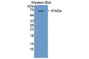 Detection of Recombinant VEGFR2, Porcine using Polyclonal Antibody to Vascular Endothelial Growth Factor Receptor 2 (VEGFR2) (VEGFR2/CD309 antibody  (AA 8-290))