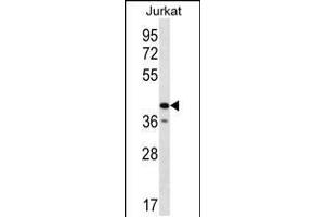 Western blot analysis in Jurkat cell line lysates (35ug/lane). (GORASP2 antibody  (AA 185-214))