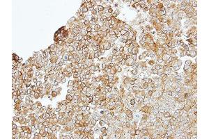 IHC-P Image Immunohistochemical analysis of paraffin-embedded TOV-112D xenograft, using JAM-B, antibody at 1:100 dilution. (JAM2 antibody)