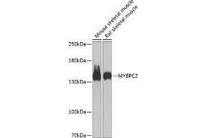 Western blot analysis of extracts of various cell lines, using MYBPC2 antibody (ABIN6129607, ABIN6144217, ABIN6144219 and ABIN6217282) at 1:1000 dilution. (MYBPC2 antibody  (AA 912-1141))