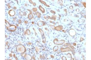 Immunohistochemistry (IHC) image for anti-ADP-Ribosylation Factor 1 (ARF1) antibody (ABIN6939846)