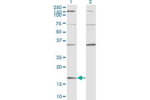 Western Blot analysis of RARRES2 expression in transfected 293T cell line by RARRES2 monoclonal antibody (M02), clone 3E3. (Chemerin antibody  (AA 17-163))