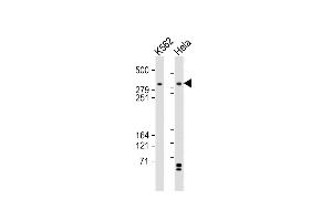 All lanes : Anti-TRR Antibody (C-term) at 1:2000 dilution Lane 1: K562 whole cell lysates Lane 2: Hela whole cell lysates Lysates/proteins at 20 μg per lane. (TRRAP antibody  (C-Term))